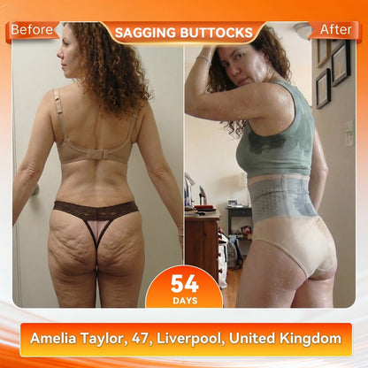 Moringa & Berberine 4-In-1 Micro-Particle Sculpting & Fat-Burn Shorts