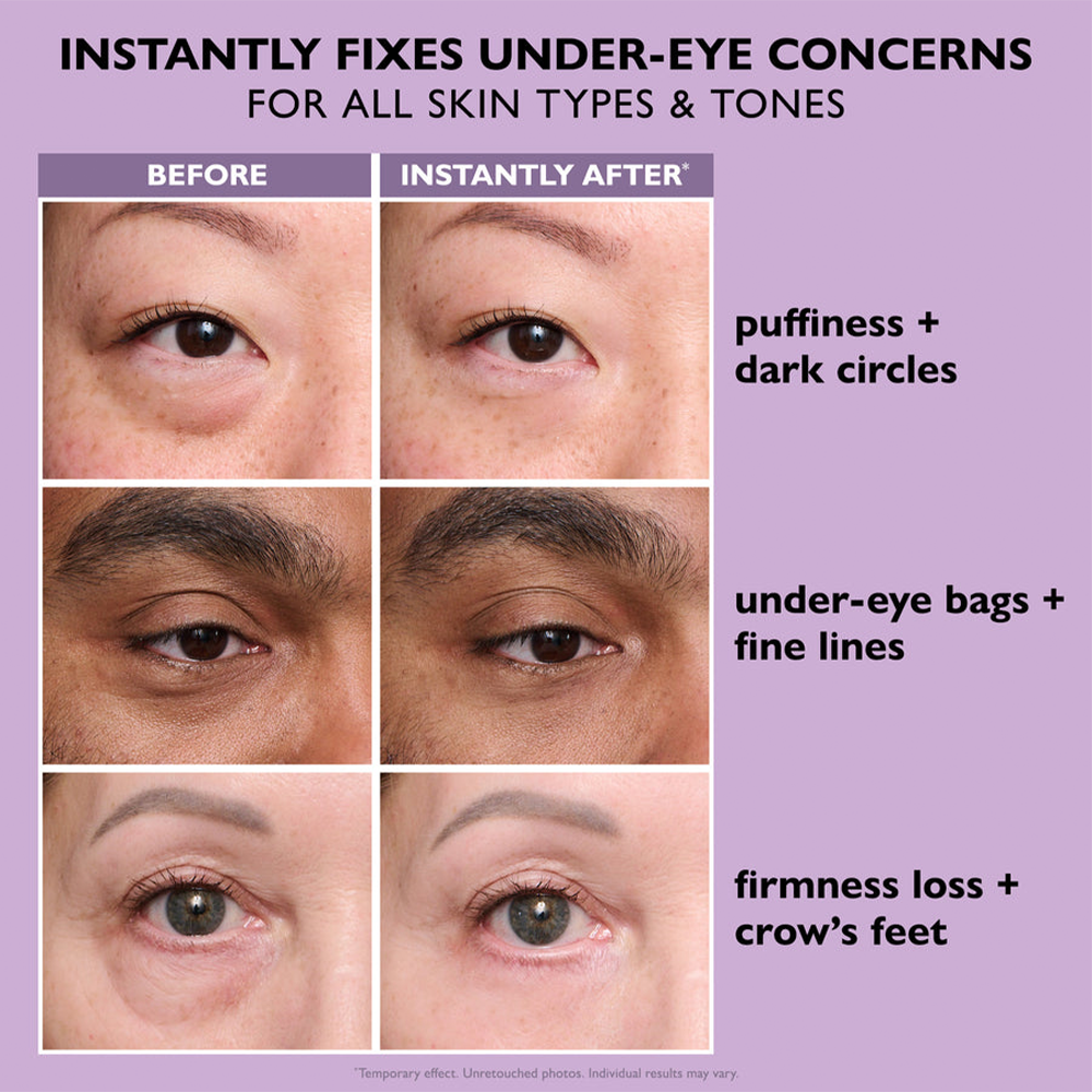 LZENN™ Eye Bag Instant Eraser, Tightens, Firms, & Blurs Wrinkles