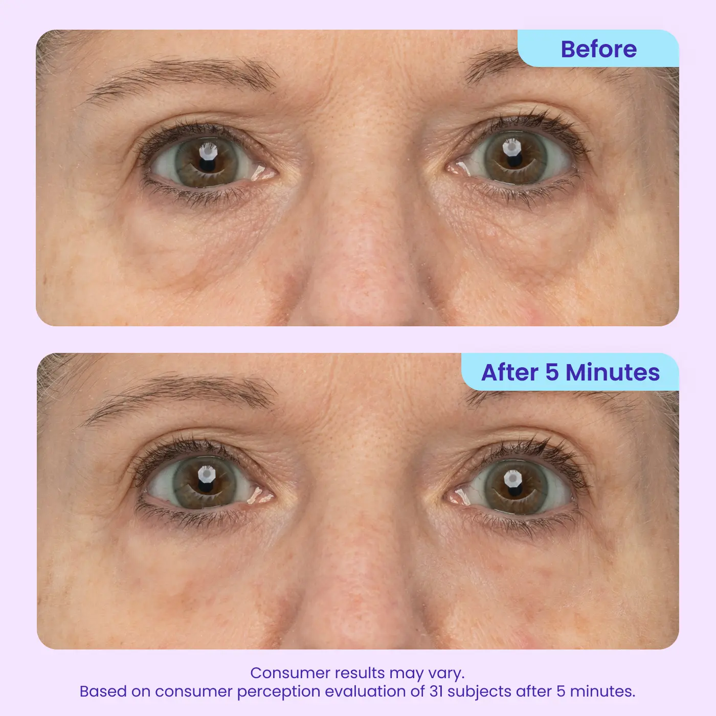 LZENN™ Eye Bag Instant Eraser, Tightens, Firms, & Blurs Wrinkles