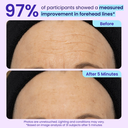 LZENN™ Eye Bag Instant Eraser, Tightens, Firms, & Blurs Wrinkles