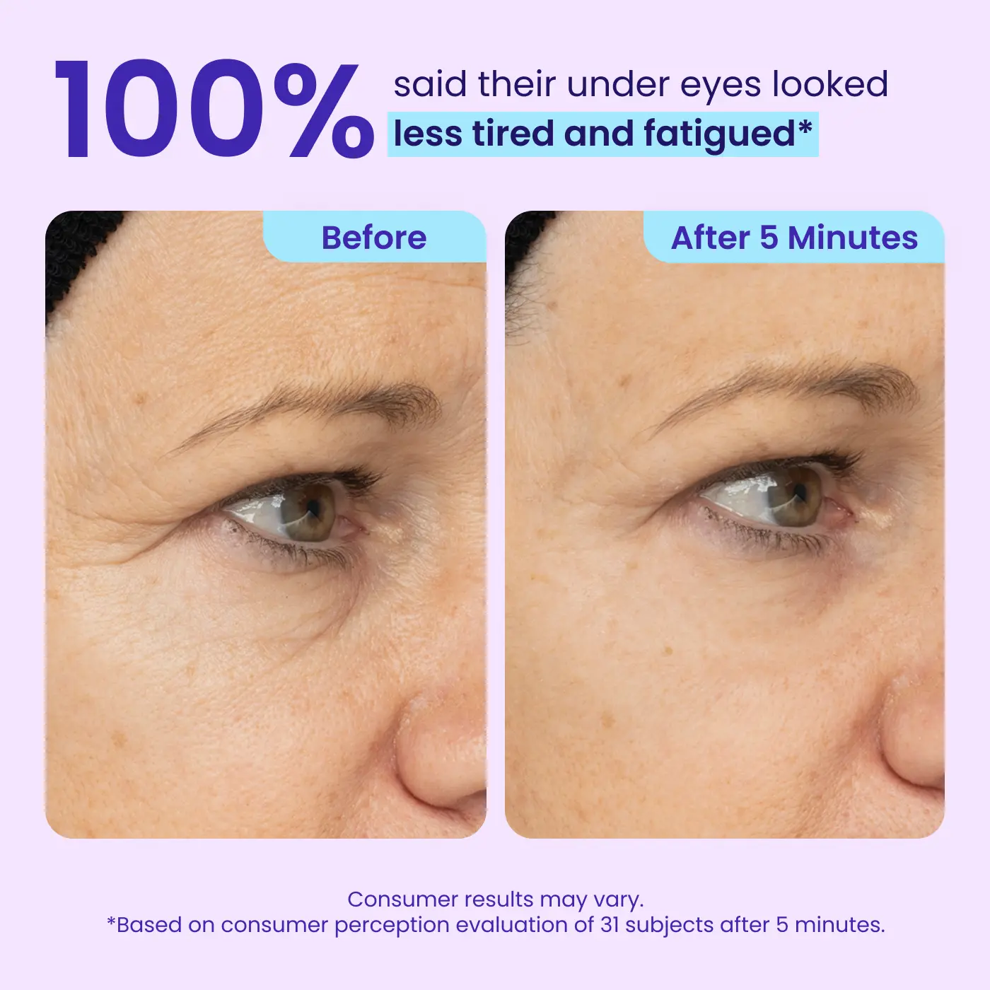 LZENN™ Eye Bag Instant Eraser, Tightens, Firms, & Blurs Wrinkles